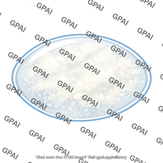 Lens protein denatured