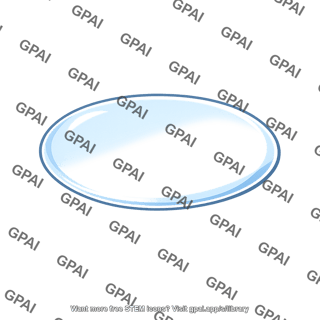 Astigmatic lens