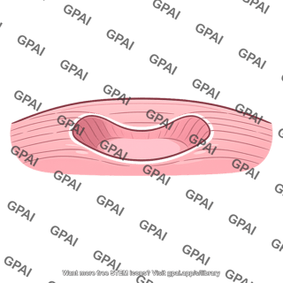 Synaptic trough