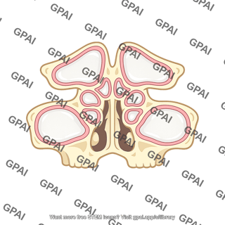Nasal sinus
