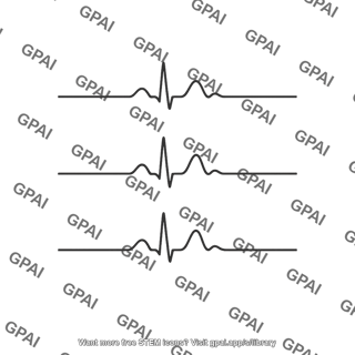 Ecg waveforms