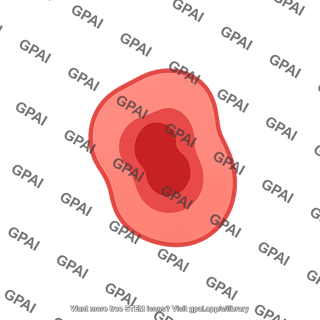 Ductal cell cancerous 1