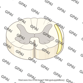Lateral spinothalamic tract