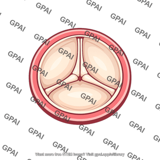 Pulmonary valve