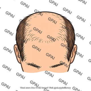 Scalp baldness