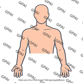Head and upper extremities