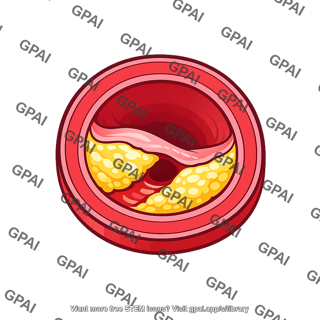 Atherosclerotic artery
