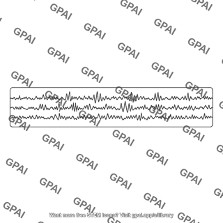 Electroencephalogram