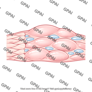 Tissue edema