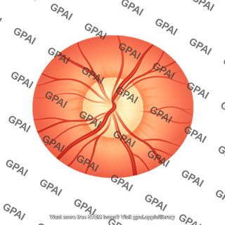 Optic disc