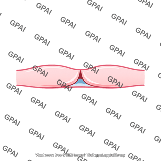 Capillary slit pore
