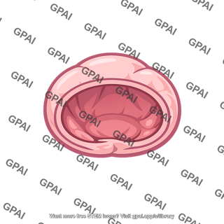 Alveolus unventilated