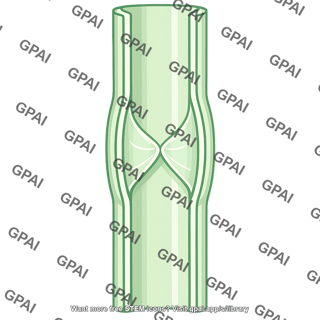 Lymphatic valve