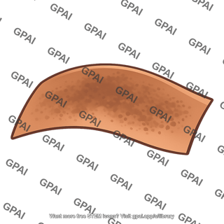 Addison disease skin