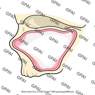 Maxillary sinus