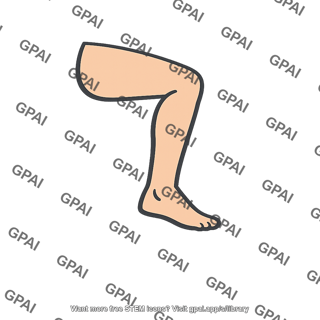 Bent leg
