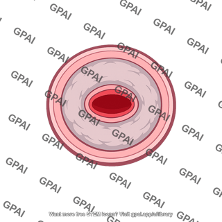 Blood vessel thickened