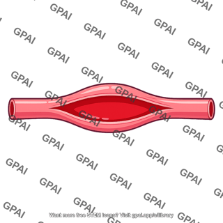 Blood vessel stretched