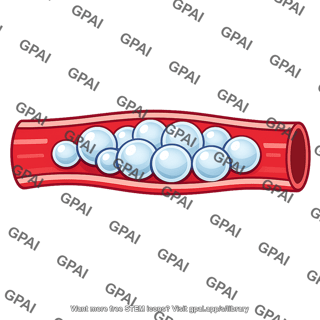 Air embolism