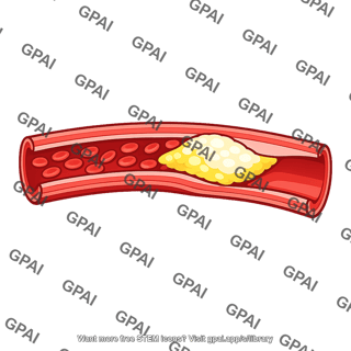 Artery atherosclerotic