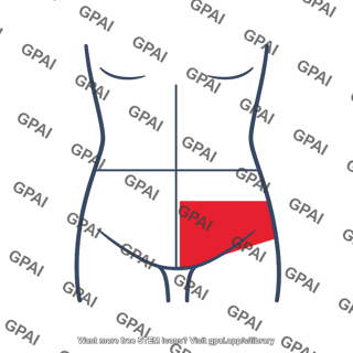 Abdomen right lower quadrant