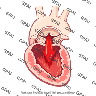 Aortic regurgitation