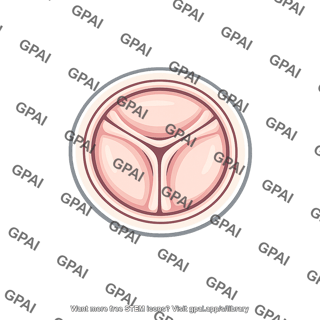 Pulmonary artery valve