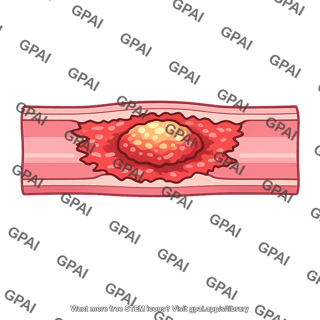 Vascular lesion