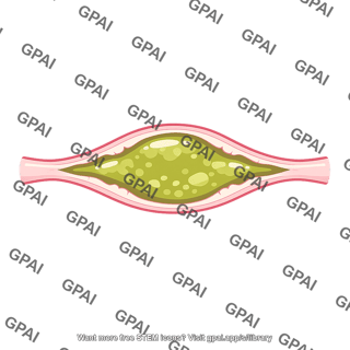Bile canaliculus congested