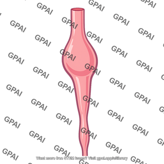 Esophagus achalasia
