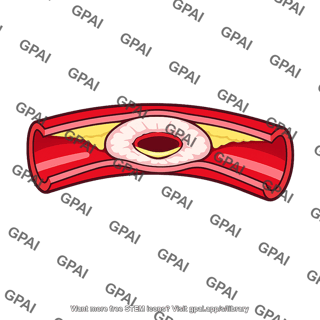 Coronary artery restenosed