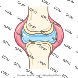 Swollen joint space