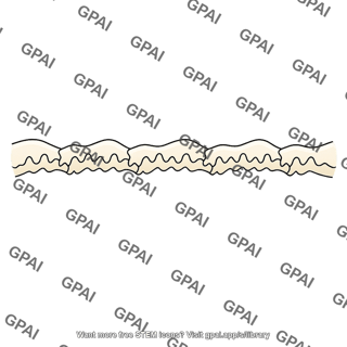 Cranial suture