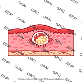 Uterus implanting embryo