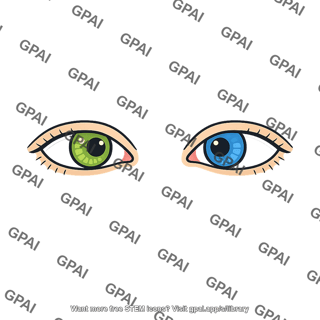 Heterochromia eyes