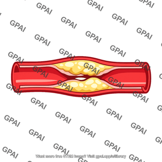 Coronary artery atherosclerotic