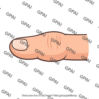 Finger thickened