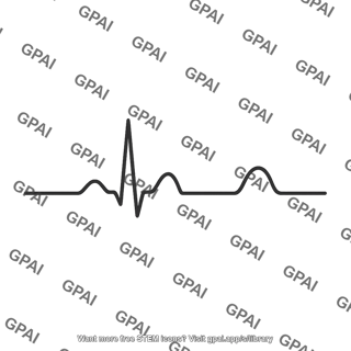 Ecg waveform