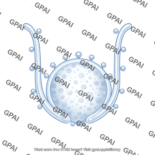 Medium vesicle stage 5