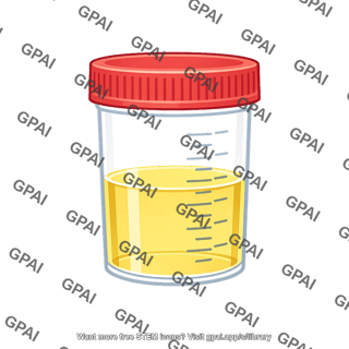 Urine specimen container marked