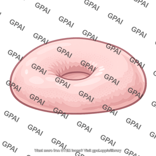 Edema pitting