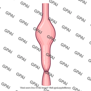 Achalasia