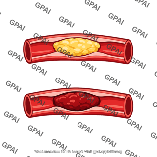 Coronary occlusion