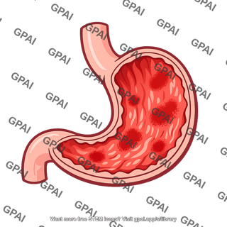 Gastritis