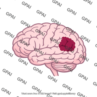 Brain with lesion