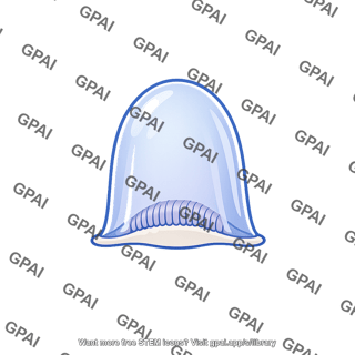 Cupula