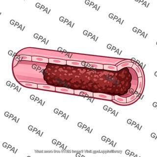 Kidney tubule blocked