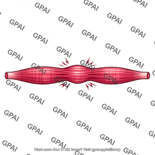 Muscle fiber overloaded