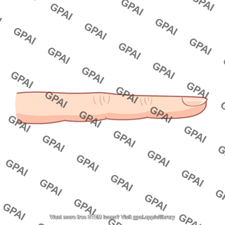 Finger extended