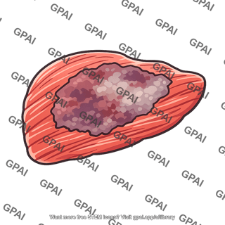 Ischemic heart tissue